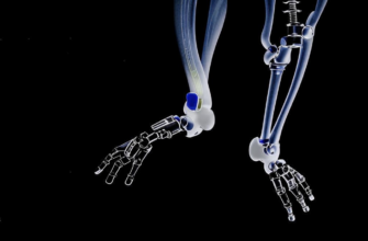 «Ах руки моей нога...»